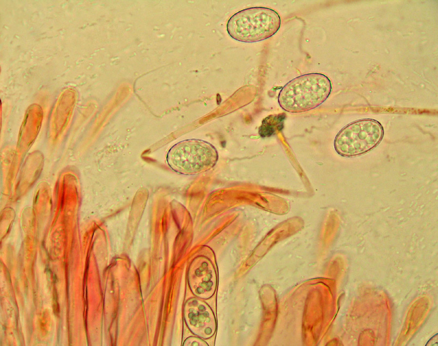 Scutellinia sp